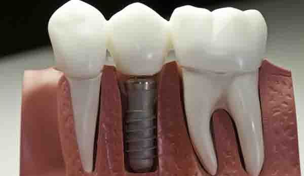 ��ֲ�����